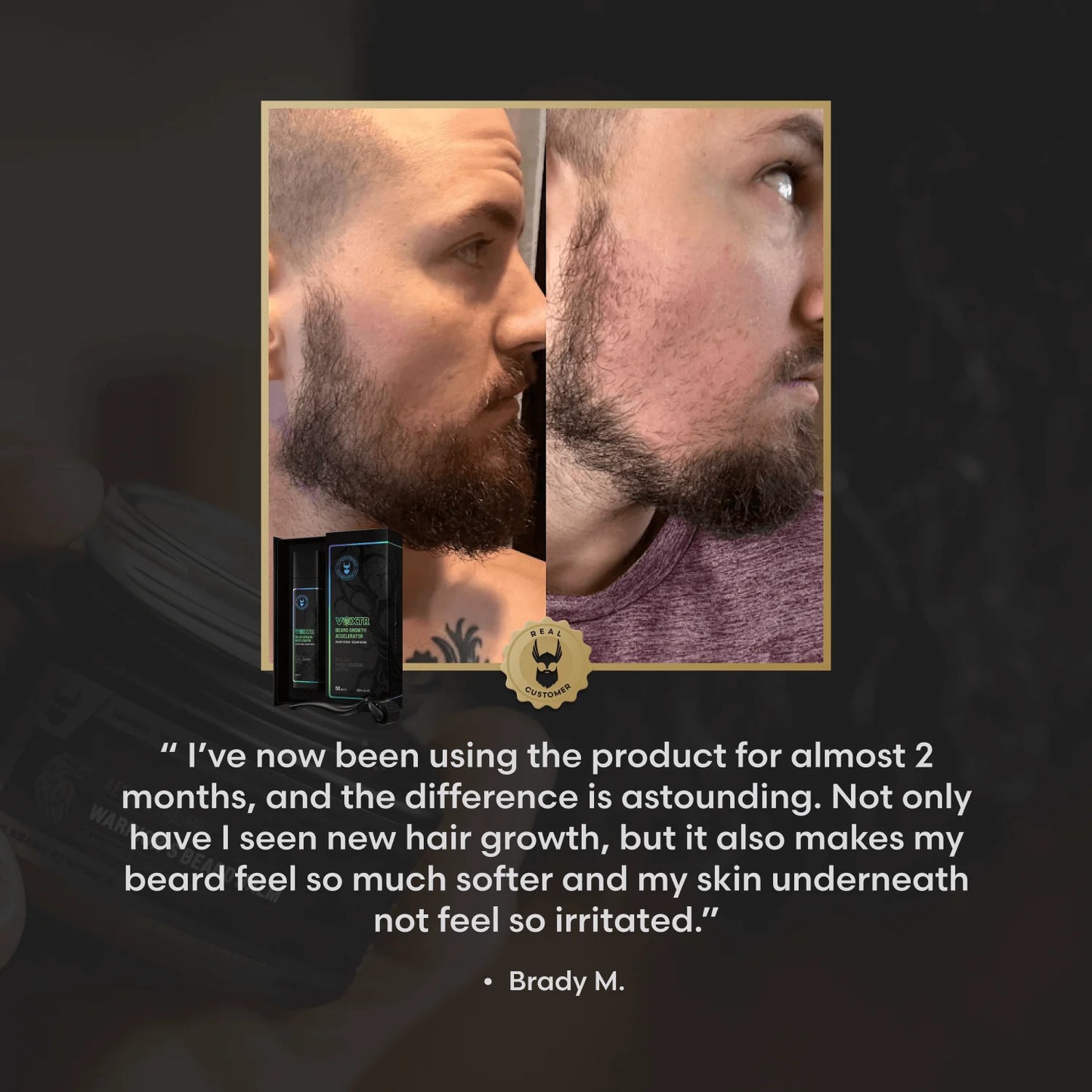 VOXTR SKJEGGAKSELERATORSERUM