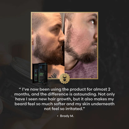 VOXTR SKJEGGAKSELERATORSERUM